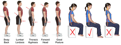 Examples of goodand bad body posture